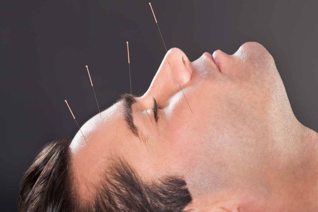 چند جلسه بعد طب سوزنی جواب میدهد ؟