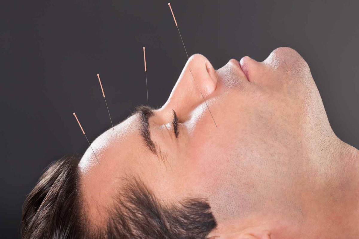 چند جلسه بعد طب سوزنی جواب میدهد ؟