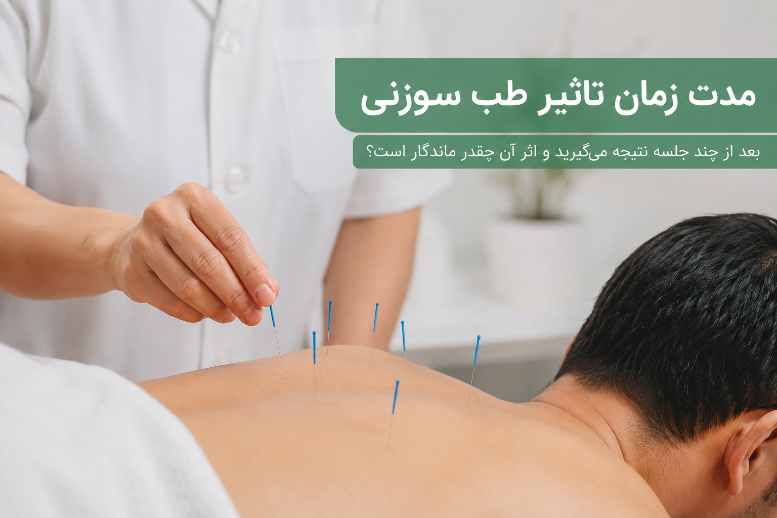 مدت زمان تاثیر طب سوزنی؛ بعد از چند جلسه نتیجه می‌گیرید و اثر آن چقدر ماندگار است؟